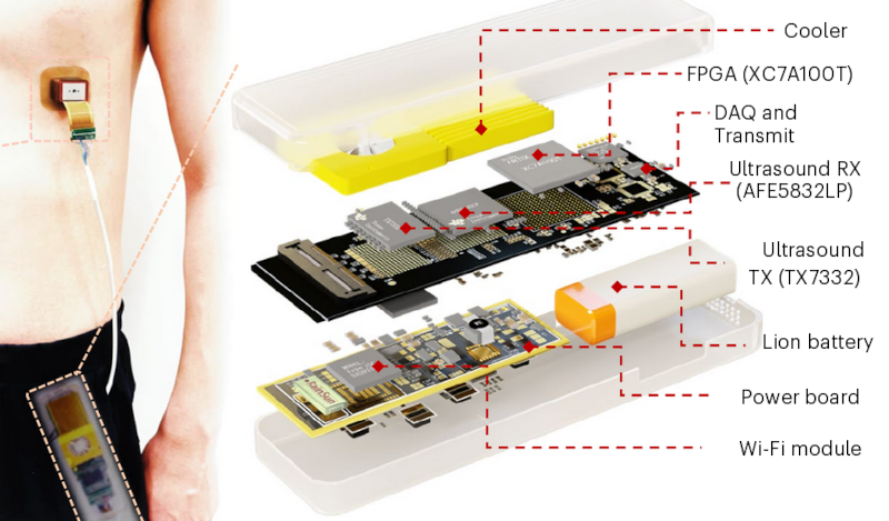 The Pacemaker Patch - Hackaday