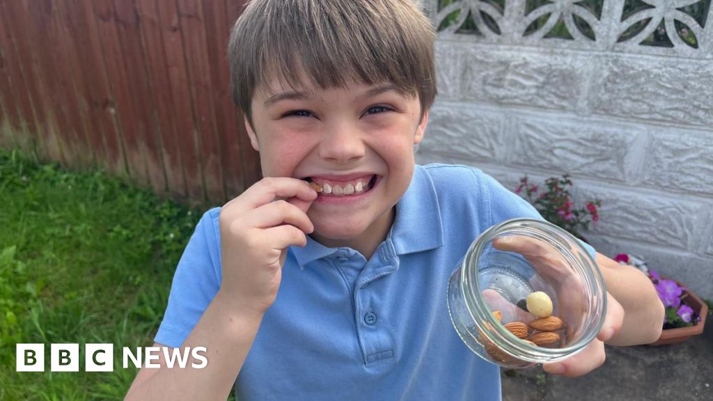Anaphylaxis concerns for Cardiff boy, 10, with 20 allergies - BBC